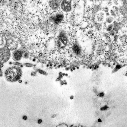 Imagem microscópica de partículas de SARS-Cov-2